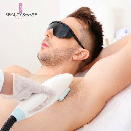 laserová epilace praha