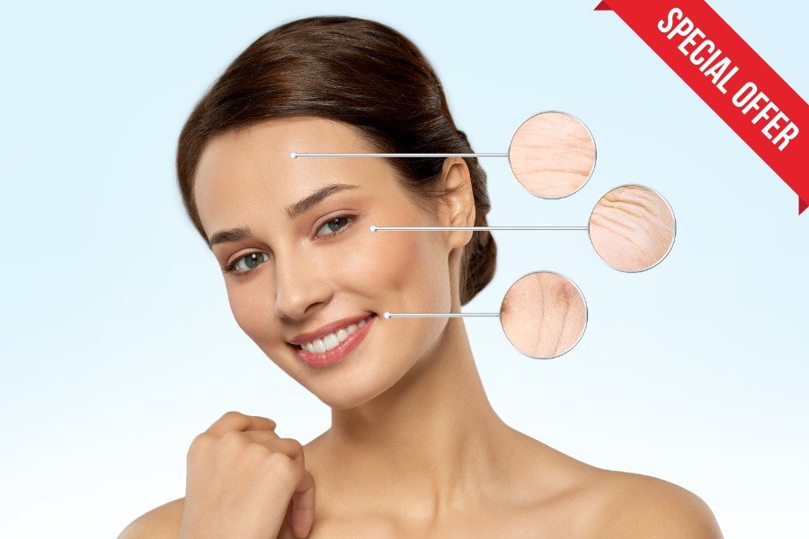 Vyhlazení vrásek 1+1 ZDARMA! vyhlazení vrásek botox