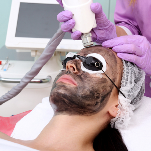 Karbonový peeling. Laserový hollywood peel