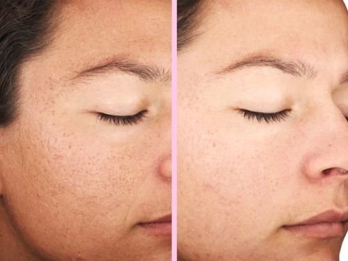 Image is not available