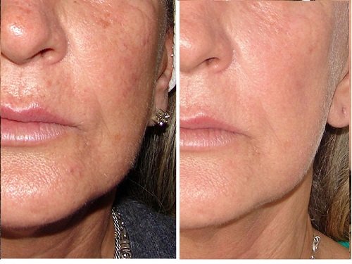 Image is not available