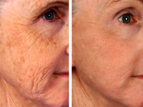 Image is not available