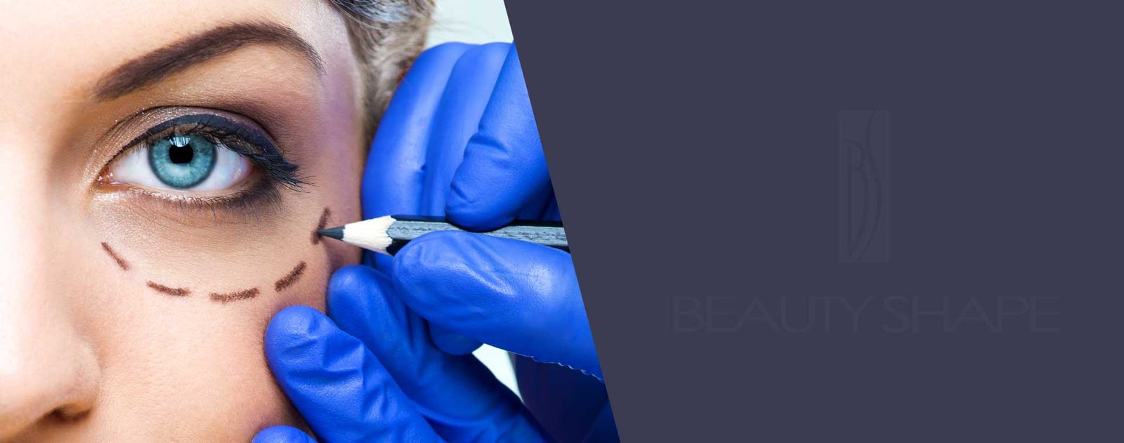 Eyelid Surgery (Blepharoplasty)