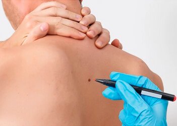 LPG Lipomasáž od Endermologie LPG Lipomasáž od Endermologie